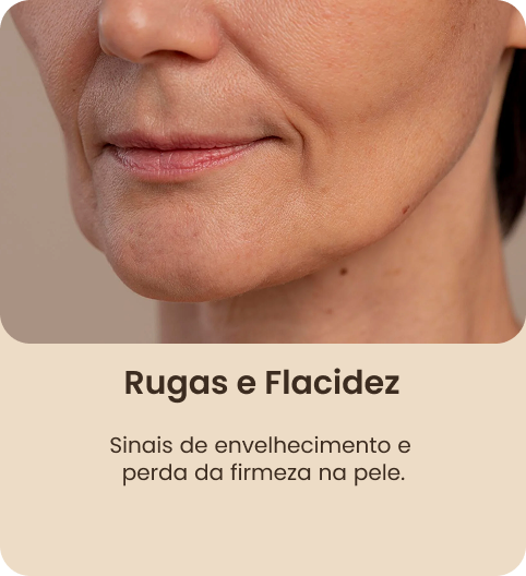 RETANGULO 13