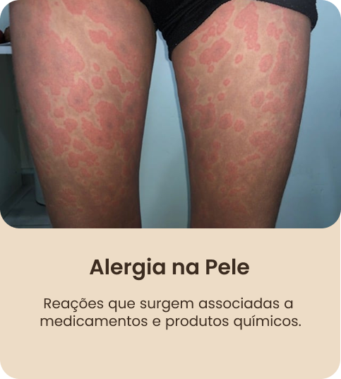 RETANGULO 18