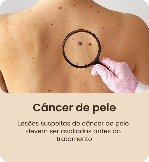 RETANGULO 2